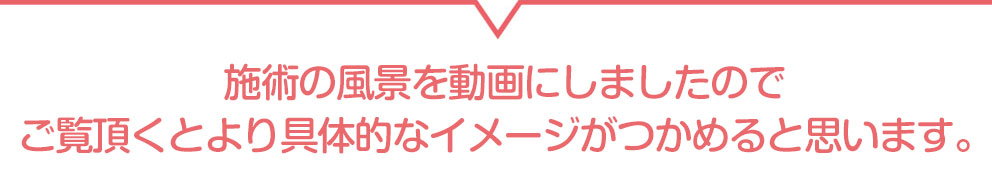施術の風景を動画にしましたのでご覧頂くとより具体的なイメージがつかめると思います。