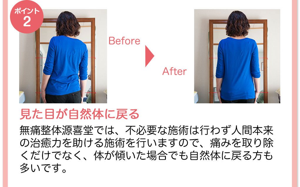 【ポイント2】見た目が自然体に戻る　無痛整体源喜堂では不必要な施術は行わず人間本来の治癒力を助ける施術を行いますので、痛みを取り除くだけでなく、体が傾いた場合でも自然体に戻る方も多いです。